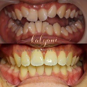 Kalyani Dental Lounge and Gallery