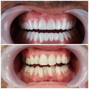 True Smiles UK
